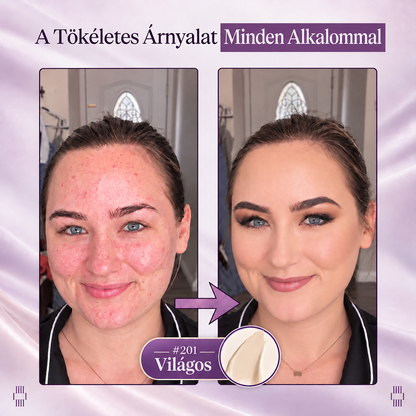 🔥 𝐀𝐙 𝐔𝐓𝐎𝐋𝐒Ó 𝟐 Ó𝐑Á𝐁𝐀𝐍 · 𝟖𝟎% 𝐊𝐄𝐃𝐕𝐄𝐙𝐌É𝐍𝐘! 𝐇𝐢𝐬𝐤𝐢𝐧® 𝟐 𝐚𝐳 𝟏-𝐛𝐞𝐧 𝐬𝐳í𝐧𝐯á𝐥𝐭ó 𝐚𝐥𝐚𝐩𝐨𝐳ó 𝐬𝐭𝐢𝐟𝐭 | 𝐄𝐥𝐟𝐞𝐝𝐢 𝐚𝐳 ö𝐫𝐞𝐠𝐬é𝐠𝐢 𝐟𝐨𝐥𝐭𝐨𝐤𝐚𝐭, 𝐡𝐚𝐥𝐯á𝐧𝐲í𝐭𝐣𝐚 𝐚 𝐟𝐢𝐧𝐨𝐦 𝐫á𝐧𝐜𝐨𝐤 𝐥á𝐭𝐡𝐚𝐭ó𝐬á𝐠á𝐭 é𝐬 𝐡𝐢𝐝𝐫𝐚𝐭á𝐥𝐣𝐚 𝐚 𝐛ő𝐫𝐭 – 𝐛𝐞é𝐩í𝐭𝐞𝐭𝐭 𝐞𝐜𝐬𝐞𝐭𝐭𝐞𝐥 𝐚 𝐟𝐢𝐚𝐭𝐚𝐥𝐨𝐬, 𝐫𝐚𝐠𝐲𝐨𝐠ó 𝐚𝐫𝐜𝐛ő𝐫é𝐫𝐭!