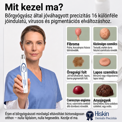 Hivatalos Márkabolt | 🚢 Hiskin® 7 napos Szemölcseltávolító Roll-on Ápoló Folyadék (Fájdalommentes rollerball technológia, hegek nélkül) 🐬 (副本)
