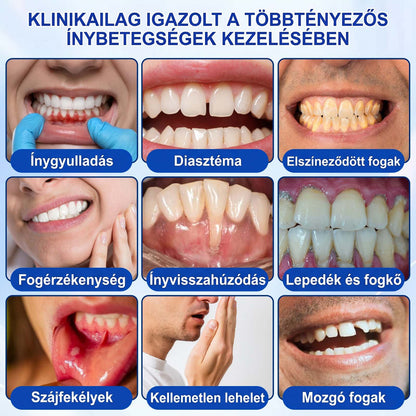 🦷🦷🦷PureShade® 🦷 GumRevive Ínyregeneráló Gél – Az egészségesebb ínyért és magabiztosabb mosolyért 👍