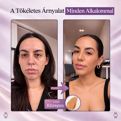 🔥 𝐀𝐙 𝐔𝐓𝐎𝐋𝐒Ó 𝟐 Ó𝐑Á𝐁𝐀𝐍 · 𝟖𝟎% 𝐊𝐄𝐃𝐕𝐄𝐙𝐌É𝐍𝐘! 𝐇𝐢𝐬𝐤𝐢𝐧® 𝟐 𝐚𝐳 𝟏-𝐛𝐞𝐧 𝐬𝐳í𝐧𝐯á𝐥𝐭ó 𝐚𝐥𝐚𝐩𝐨𝐳ó 𝐬𝐭𝐢𝐟𝐭 | 𝐄𝐥𝐟𝐞𝐝𝐢 𝐚𝐳 ö𝐫𝐞𝐠𝐬é𝐠𝐢 𝐟𝐨𝐥𝐭𝐨𝐤𝐚𝐭, 𝐡𝐚𝐥𝐯á𝐧𝐲í𝐭𝐣𝐚 𝐚 𝐟𝐢𝐧𝐨𝐦 𝐫á𝐧𝐜𝐨𝐤 𝐥á𝐭𝐡𝐚𝐭ó𝐬á𝐠á𝐭 é𝐬 𝐡𝐢𝐝𝐫𝐚𝐭á𝐥𝐣𝐚 𝐚 𝐛ő𝐫𝐭 – 𝐛𝐞é𝐩í𝐭𝐞𝐭𝐭 𝐞𝐜𝐬𝐞𝐭𝐭𝐞𝐥 𝐚 𝐟𝐢𝐚𝐭𝐚𝐥𝐨𝐬, 𝐫𝐚𝐠𝐲𝐨𝐠ó 𝐚𝐫𝐜𝐛ő𝐫é𝐫𝐭!