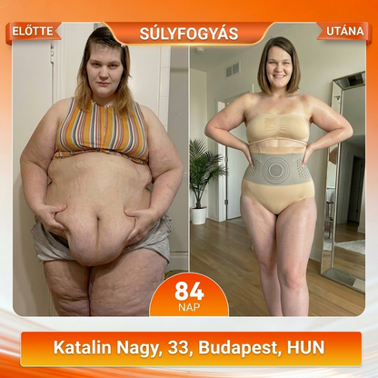 🏃🏼🏃🏼Hivatalos Márkabolt | ZUWIAY® 2026 Moringa & Berberine 4-in-1 Mikrorészecskés Alakformáló és Zsírégető Rövidnadrág