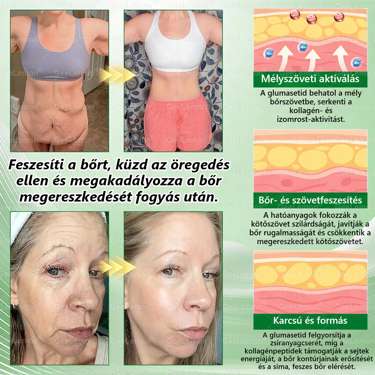 ✅❤️Moringa · Berberine × NAD+ 10-in-1 Advanced Nano GeeLemon® Glumasetide 8az 1-ben Karcsú és EgészségesNano Mikrotűs Tapasz (Napi 1alkalom – látható változásakár 7 nap alatt) ✅ Elhízásra,bőrfeszesítésre,cukorbetegségre, alvásiapnoéra, ízületekre stb HU