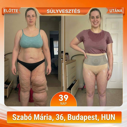 🏃🏼🏃🏼Hivatalos Márkabolt | ZUWIAY® 2026 Moringa & Berberine 4-in-1 Mikrorészecskés Alakformáló és Zsírégető Rövidnadrág