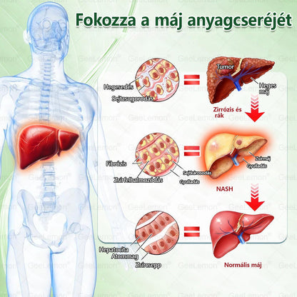 ✅❤️Moringa · Berberine × NAD+ 10-in-1 Advanced Nano GeeLemon® Glumasetide 8az 1-ben Karcsú és EgészségesNano Mikrotűs Tapasz (Napi 1alkalom – látható változásakár 7 nap alatt) ✅ Elhízásra,bőrfeszesítésre,cukorbetegségre, alvásiapnoéra, ízületekre stb HU