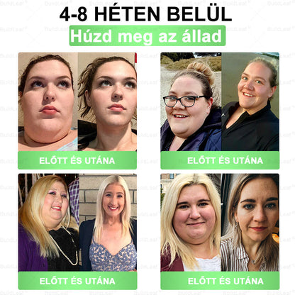 🔥Karácsonyi limitált | BuildLeaf® GLP-1 8-in-1 Orális Megoldás ✅ Támogatja az elhízás kezelését, a szív- és érrendszeri egészséget, a cukorbetegséget, az alvási apnoét, a bélrendszer egészségét, miközben feszesíti a bőrt és növeli az energiát.