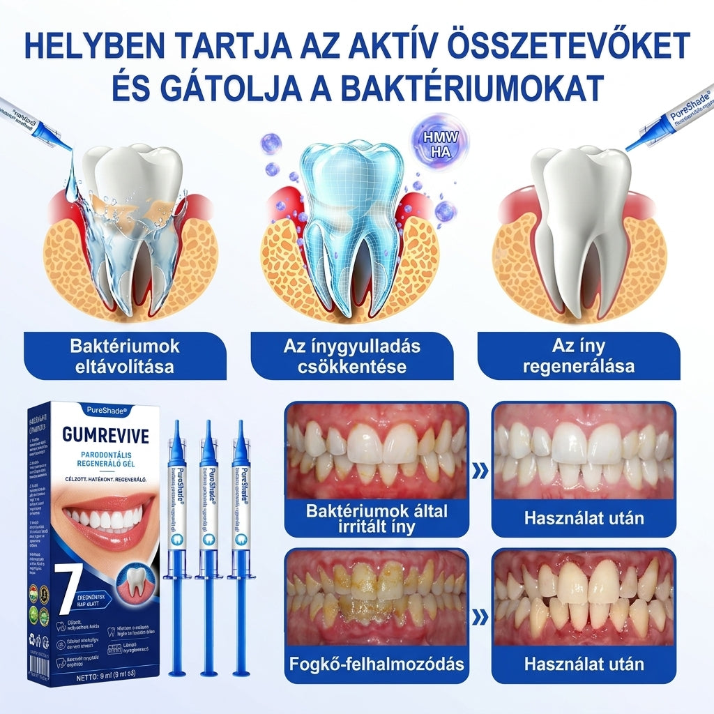 🦷🦷🦷PureShade® 🦷 GumRevive Ínyregeneráló Gél – Az egészségesebb ínyért és magabiztosabb mosolyért 👍