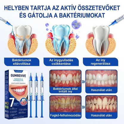 🦷🦷🦷PureShade® 🦷 GumRevive Ínyregeneráló Gél – Az egészségesebb ínyért és magabiztosabb mosolyért 👍