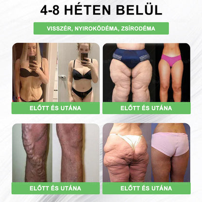 🎁 Már csak 5 doboz maradt! Most további 30% kedvezményt adunk! Legyél fitt és egészséges. Ha most nem élsz a lehetőséggel, legközelebb csak jövőre lesz rá esélyed!