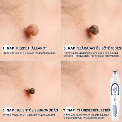 Hivatalos Márkabolt | 🚢 Hiskin® 7 napos Szemölcseltávolító Roll-on Ápoló Folyadék (Fájdalommentes rollerball technológia, hegek nélkül) 🐬 (副本)