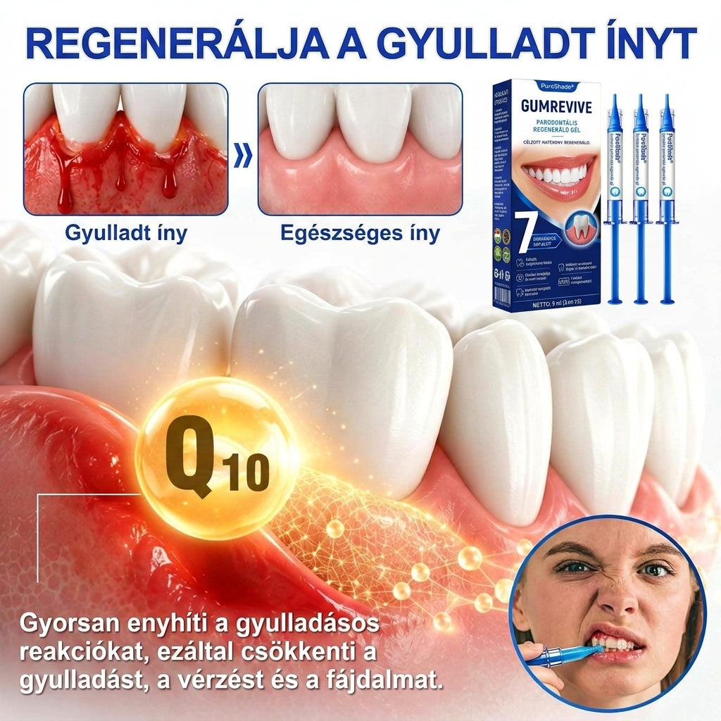 🦷🦷🦷PureShade® 🦷 GumRevive Ínyregeneráló Gél – Az egészségesebb ínyért és magabiztosabb mosolyért 👍