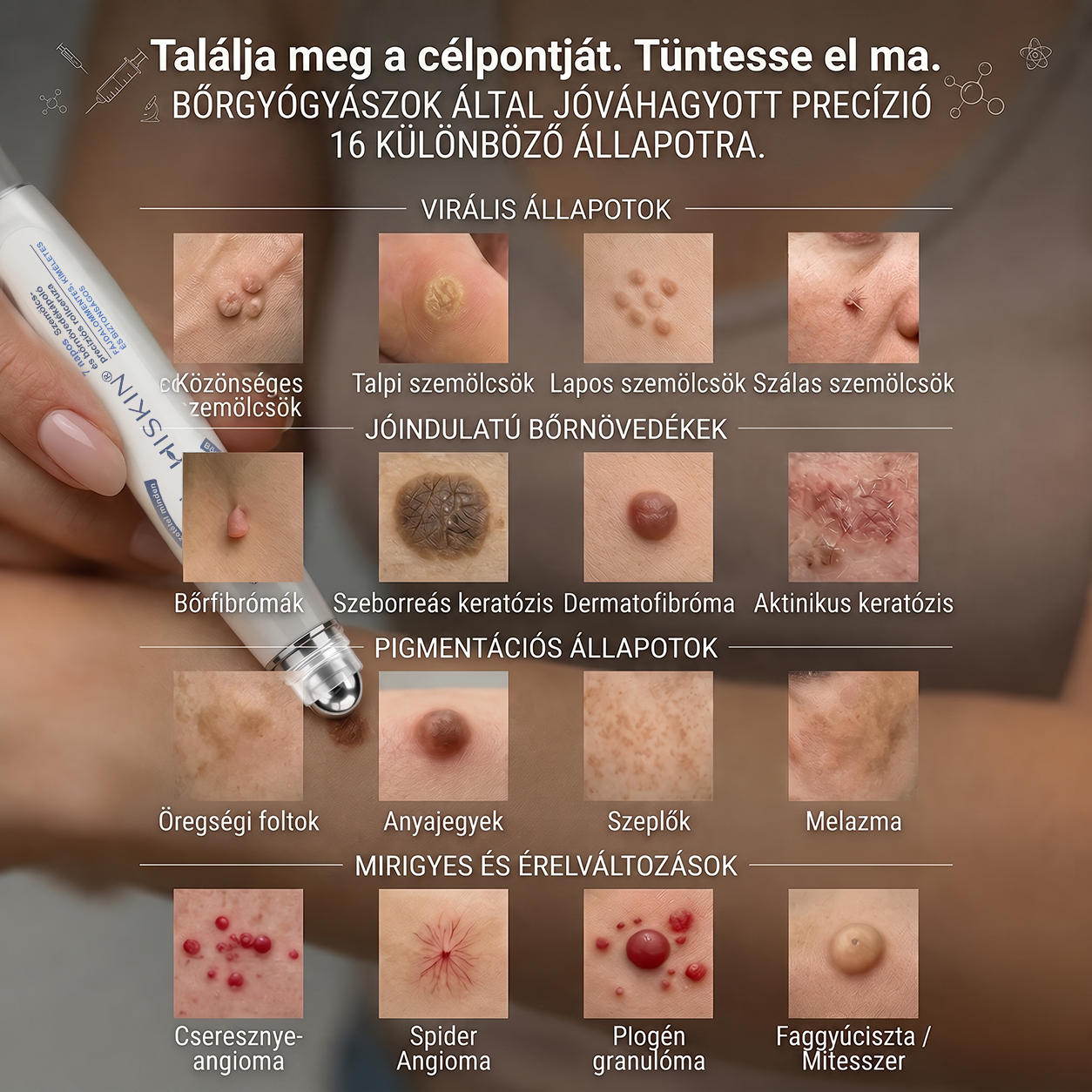 Hivatalos Márkabolt | 🚢 Hiskin® 7 napos Szemölcseltávolító Roll-on Ápoló Folyadék (Fájdalommentes rollerball technológia, hegek nélkül) 🐬 (副本)