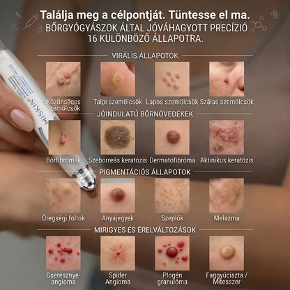 Hivatalos Márkabolt | 🚢 Hiskin® 7 napos Szemölcseltávolító Roll-on Ápoló Folyadék (Fájdalommentes rollerball technológia, hegek nélkül) 🐬 (副本)
