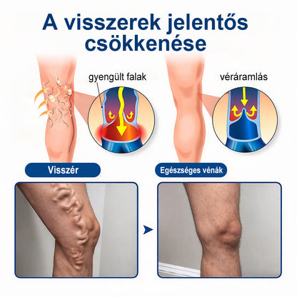 🌧️ FFBSI® Visszérápoló Mikrotűs Gondozó Tapasz ⚡ Azonnali Megkönnyebbülés, Hosszú Távú Eredmények