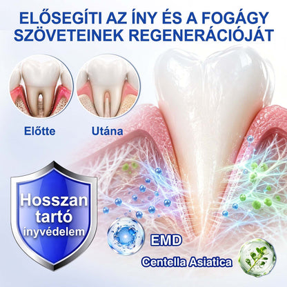 🦷🦷🦷PureShade® 🦷 GumRevive Ínyregeneráló Gél – Az egészségesebb ínyért és magabiztosabb mosolyért 👍