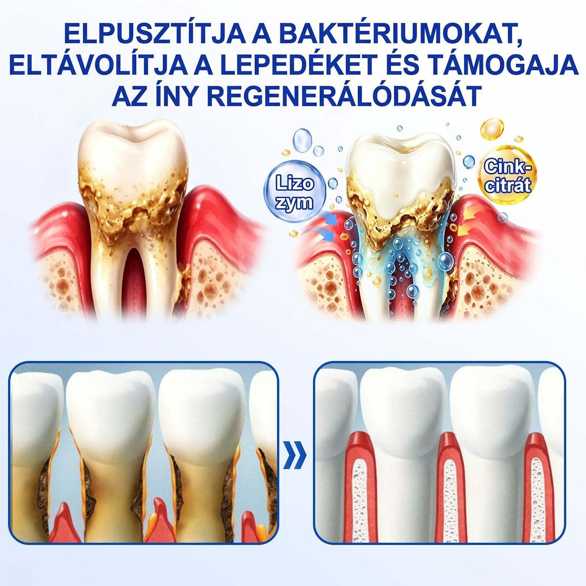 🦷🦷🦷PureShade® 🦷 GumRevive Ínyregeneráló Gél – Az egészségesebb ínyért és magabiztosabb mosolyért 👍