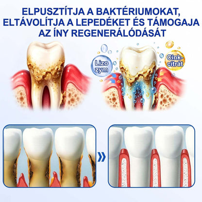 🦷🦷🦷PureShade® 🦷 GumRevive Ínyregeneráló Gél – Az egészségesebb ínyért és magabiztosabb mosolyért 👍