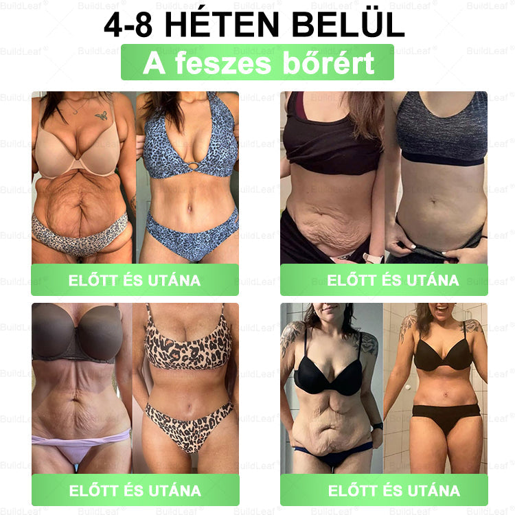 🔥Karácsonyi limitált | BuildLeaf® GLP-1 8-in-1 Orális Megoldás ✅ Támogatja az elhízás kezelését, a szív- és érrendszeri egészséget, a cukorbetegséget, az alvási apnoét, a bélrendszer egészségét, miközben feszesíti a bőrt és növeli az energiát.