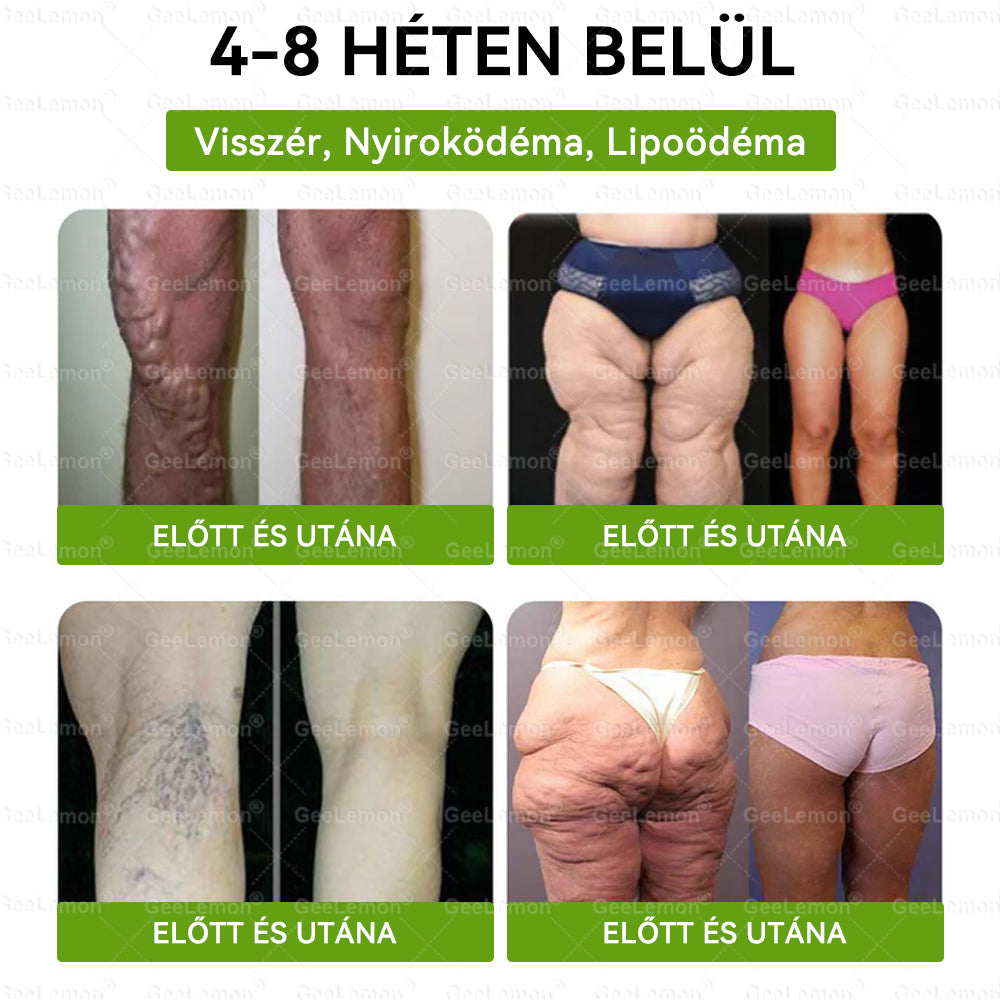 ✅❤️Moringa · Berberine × NAD+ 10-in-1 Advanced Nano GeeLemon® Glumasetide 8az 1-ben Karcsú és EgészségesNano Mikrotűs Tapasz (Napi 1alkalom – látható változásakár 7 nap alatt) ✅ Elhízásra,bőrfeszesítésre,cukorbetegségre, alvásiapnoéra, ízületekre stb HU